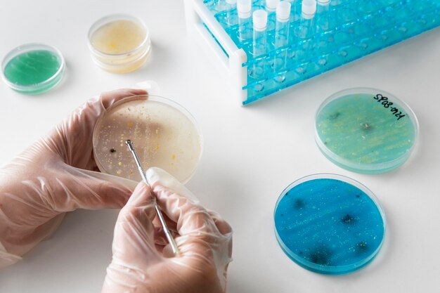 How Can Urinalysis Improve Early Detection of Urinary Tract Infections?